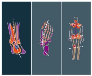 Gaitlines teknologi og din fod